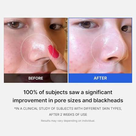 Medicube Zero Pore Pad - 70 pads