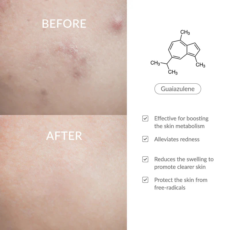 Dr. Althea 147 Barrier Cream - for Dry Skin - 50ml